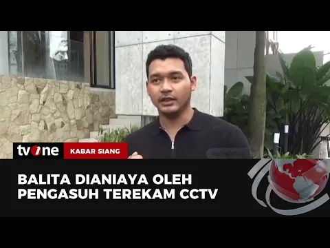 Anak Selebgram Malang Dianiaya Pengasuhnya Hingga Luka Parah