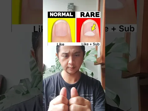 Are You Normal Or Rare #shorts #thoughts #foryoupage