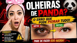 🔥OLHEIRAS DE PANDA? 😱 7 ERROS QUE PODEM DEIXAR SUAS OLHEIRAS AINDA MAIS ESCURAS!