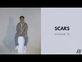 Download Lagu Keenan Te - Scars | Lirik Lagu Terjemahan