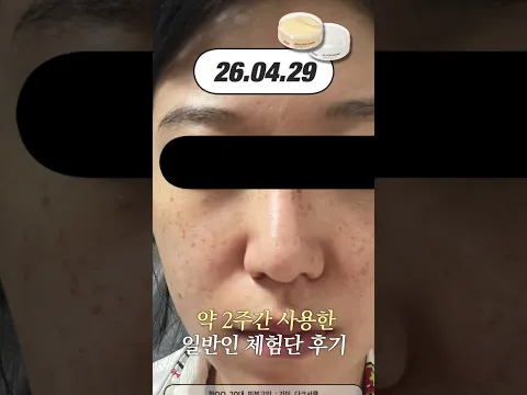 💛🤍왕 크니까 왕 죠은 대왕패치 일반인 2주 찐후기