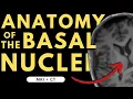 Basal ganglia basal nuclei neuroanatomy Radiology anatomy part 1 prep MRI CT