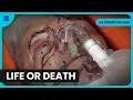 Download Lagu St Georges A\u0026E 24 Hours Life Death Emergency Room | 24 Hours in A\u0026E | Documentary