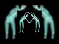 Download Lagu childish gambino - do ya like x resonance (sped up)