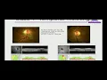 AIOC2018 - FP1172