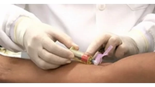 Coleta de sangue - Diagnóstico e monitoramento das DST, Aids e Hepatites Virais