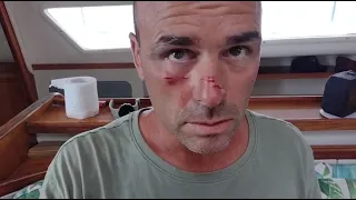 Drone Accident. Drones are DANGEROUS!