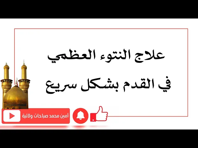 ⁣علاج النتوء العظمي في القدم بشكل سريع وازالته كما هو مجرب وكما ورد عن أهل البيت عليهم السلام