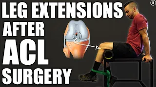 How To Program Leg Extensions Safely After ACL Rescontruction (3 Phases)