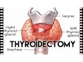CCO CPC Exam Exercises Thyroidectomy Practice Exam Question
