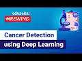 Cancer Detection Using Deep Learning Deep Learning Projects Edureka