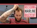 Shaving receding hair to a grade 2