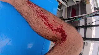 SPEARFISHING ACCIDENT! Sliced Artery B2B Pacific Tour (Ep:25)