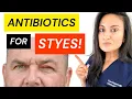 BEST Antibiotic For Stye Treatment Get Rid Of Eye Stye Chalazion Medication Ointment