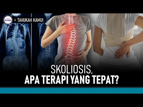 Apa Terapi yang Tepat untuk Skoliosis?
