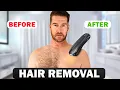 At Home Laser Hair Removal That Works ULike X IPL Device Full Review Results