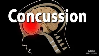 Download Concussion: Pathophysiology, Causes, Symptoms and Treatment, Animation MP3