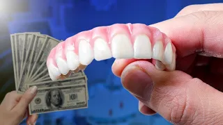 Full Mouth Dental Implant Cost and Comparison