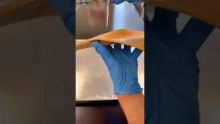 How Stretch Marks Happen