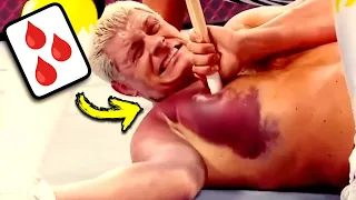 Doctor Reacts To Painful WWE Injuries