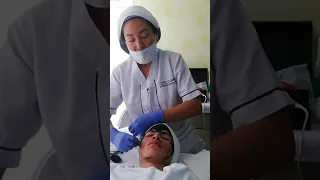 tratamiento para acn grado 3 con laser