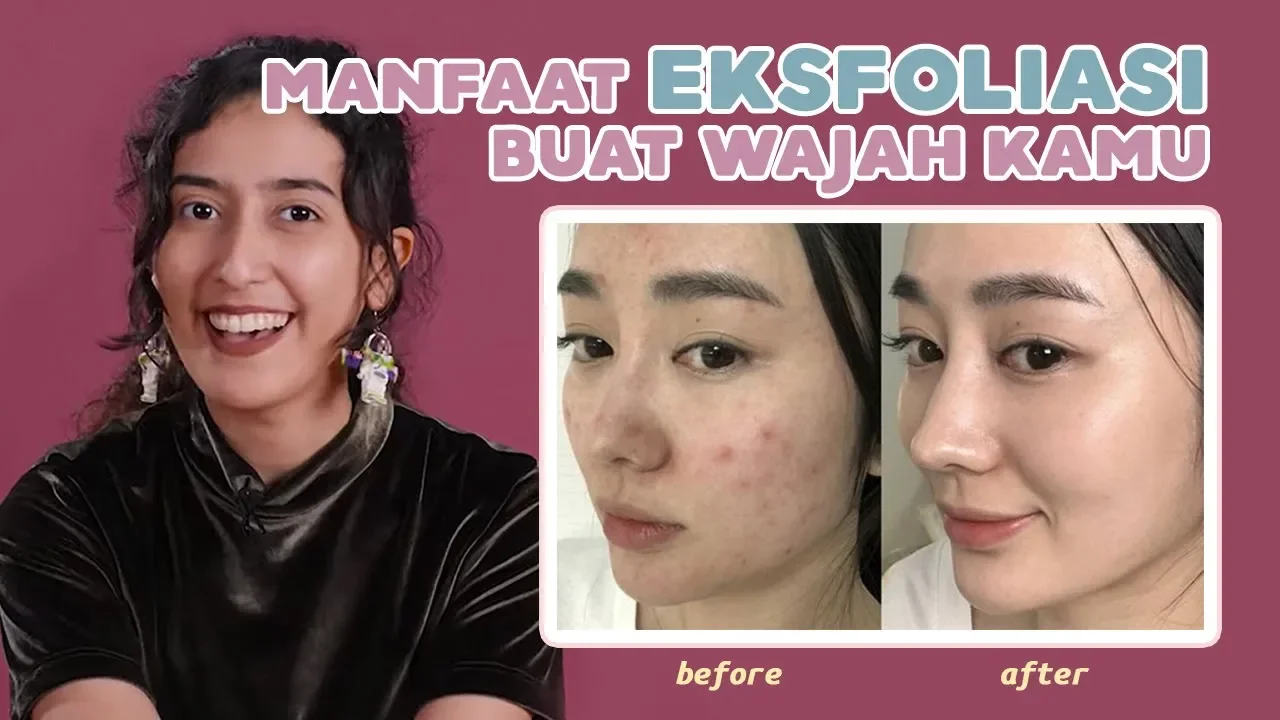 Yo bro kali ini gua akan ngebahas tentang jenis-jenis kulit wajah. sebelum lo memulai untuk merawat . 