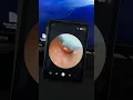 Download Lagu Try this game-changing ear wax removal tool with camera #earwax