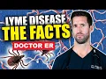 What Is Lyme Disease Signs and Symptoms of Untreated Lyme Disease in Humans Doctor ER