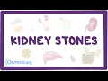 Kidney stones nephrolithiasis - an Osmosis