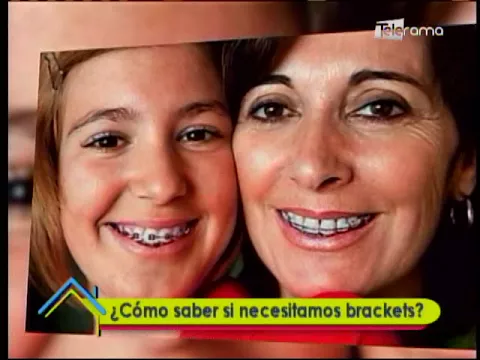 ¿Cómo saber si necesitamos brackets?