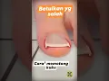 Download Lagu Cara potong kuku kaki yang benar
