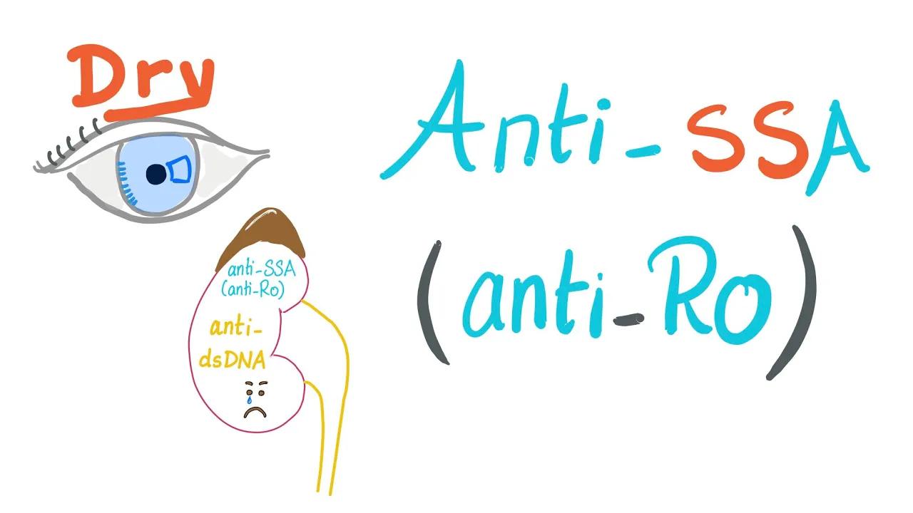 Anti-SSA (Anti-Ro) Autoantibodies - Sjögren Syndrome - Rheumatology and Immunology