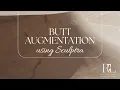 Butt Augmentation with Sculptra Aesthetic
