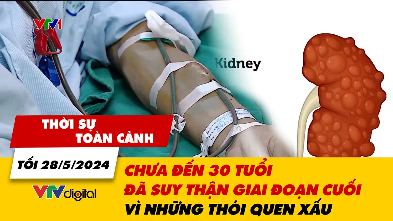 Outline Video Thời sự toàn cảnh tối 28/5: Chưa đến 30 tuổi đã suy thận giai đoạn cuối vì thói quen xấu | VTV24