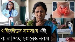 থাইৰইড ৰ বিষয়ে এই কেইটা কথা জানিলে আচৰিত হব || Ponkhi Sharma