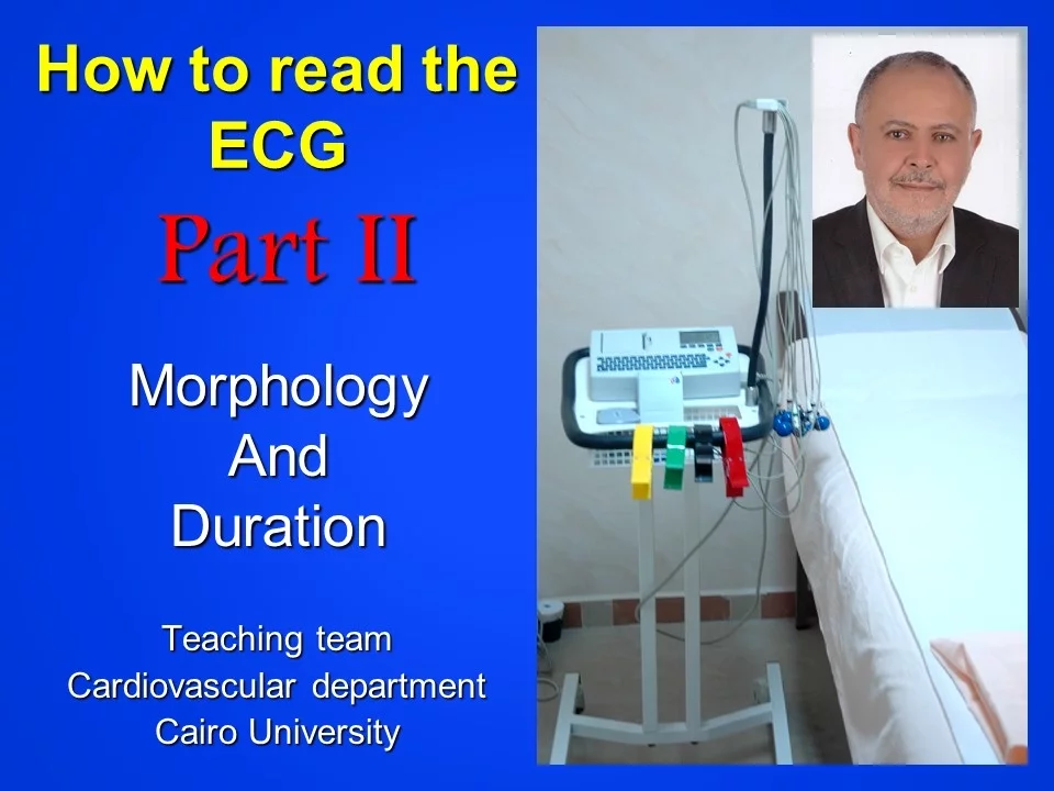 ECG part II