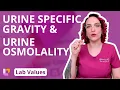 Urine Specific Gravity Urine Osmolality Lab Values for adults Nursing School LevelUpRN