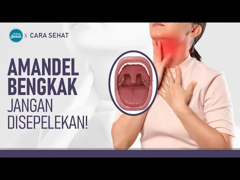 Radang Amandel Jangan Sepelekan! Ini Penyebabnya