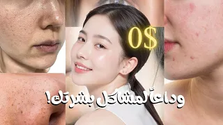 حل كل مشاكل البشرة طبيعيا الحبوب تفتيح الرؤوس السوداء توحيد اللون الهالات 