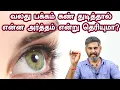 Download Lagu Do you know what it means when the eye blinks to the right? Magesh iyer |ASM INFO |Anmeegathagaval