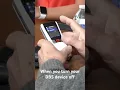 Download Lagu Steve turned off his DBS device to show us his Parkinson’s tremors! #viral #dbs #parkinsons #tremor