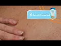 TENA ProSkin 3 Step Solution Barrier Cream