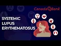 Systemic Lupus Erythematosus Explained Diagnosis Antibodies Management CanadaQBank