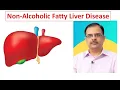 NAFLD-Pathogenesis clinical features and management