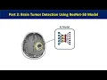 Part 2 Brain Tumor detection Using Deep Learning Transfer Learning ResNet Tensorflow Keras