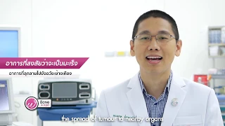 โรคมะเร็งต่อมน้ำลายมีอาการอย่างไร ที่ควรสงสัยว่าอาจเป็นมะเร็ง