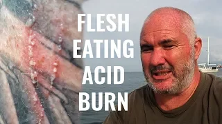 What is Malaysia doing to its coral reefs?!? Ep 140