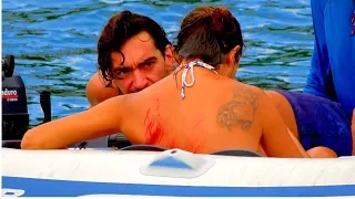 SSL 192 ~ Shascha hit by dinghy while snorkelling.. during preparations for Tropical Storm DON