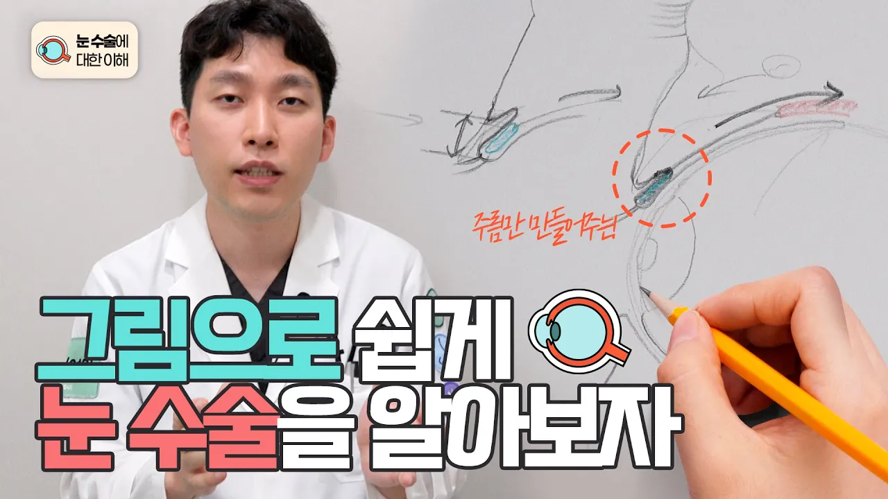 쌍꺼풀 수술 궁금증! 구조부터 절개, 비절개까지 그림으로 쉽게 알려드립니다 👀✨_[4월31일 성형외과]