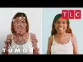 Charmaine s Life-Altering Transformation Take My Tumor TLC